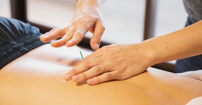 Suffering from Chronic Pain? Acupuncture Can Help