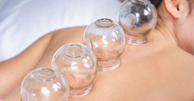 Cosmetic Acupuncture/Microneedling