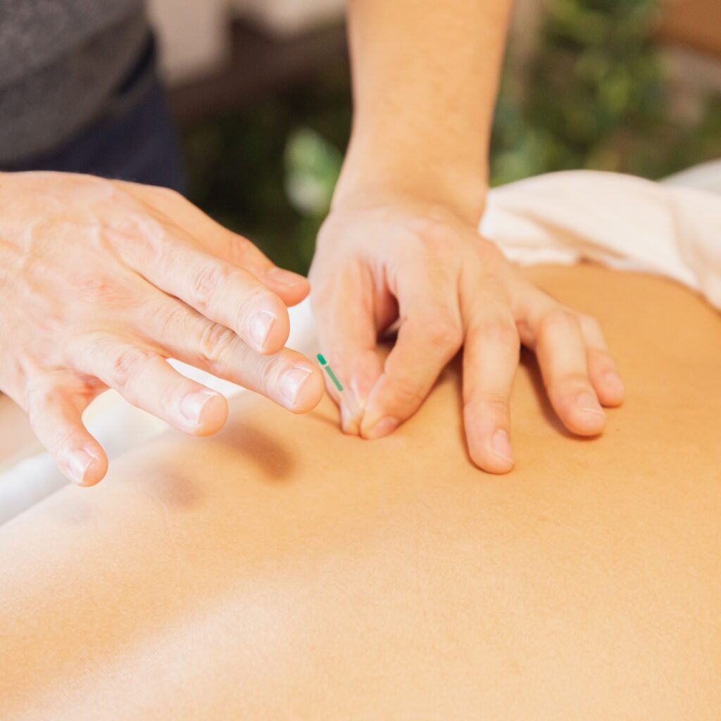 Many people suffer from chronic pain, but acupuncture can help you find relief.
